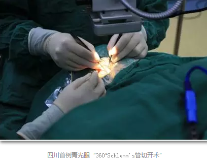成都太阳成tyc7111cc已经开展的青光眼手术有：引流阀 (钉)植入手术(2015年以来已200多 )，360°Schlemm's管切开术，激光CO2 辅助巩膜深层切除术，小梁切除术青(光眼)白(内障)联合手术。还有虹膜周切术、前房成形术、 虹膜复位术，睫状体冷冻术，小梁切开术和前房穿刺术等6.png