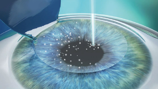 热血沸腾想参军,你的视力跟上了吗?厦门眼科中心医生这样建议3.png 热血沸腾想参军,你的视力跟上了吗?厦门眼科中心医生这样建议3.png