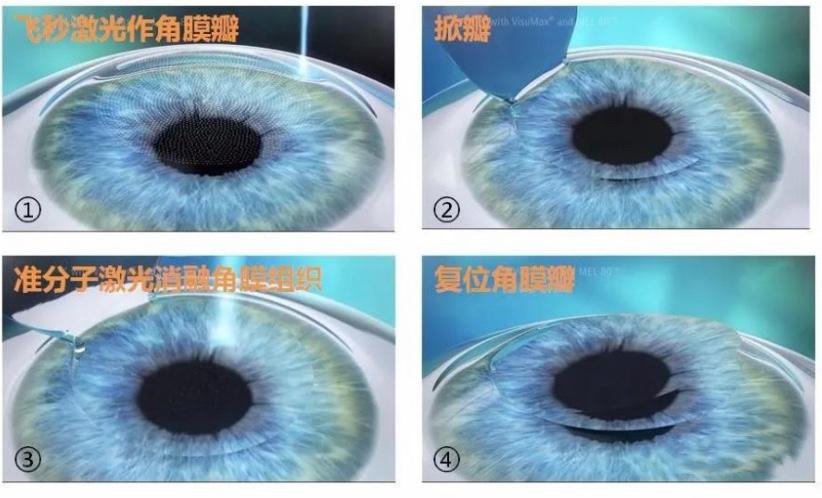 半飞秒1.jpg 半飞秒1.jpg