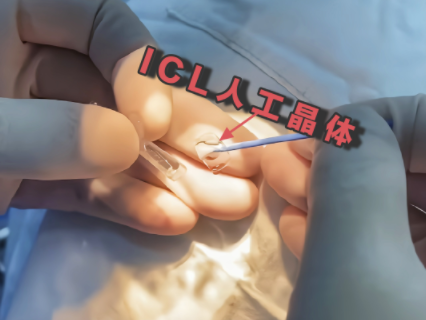 1692167009480.png 1692167009480.png